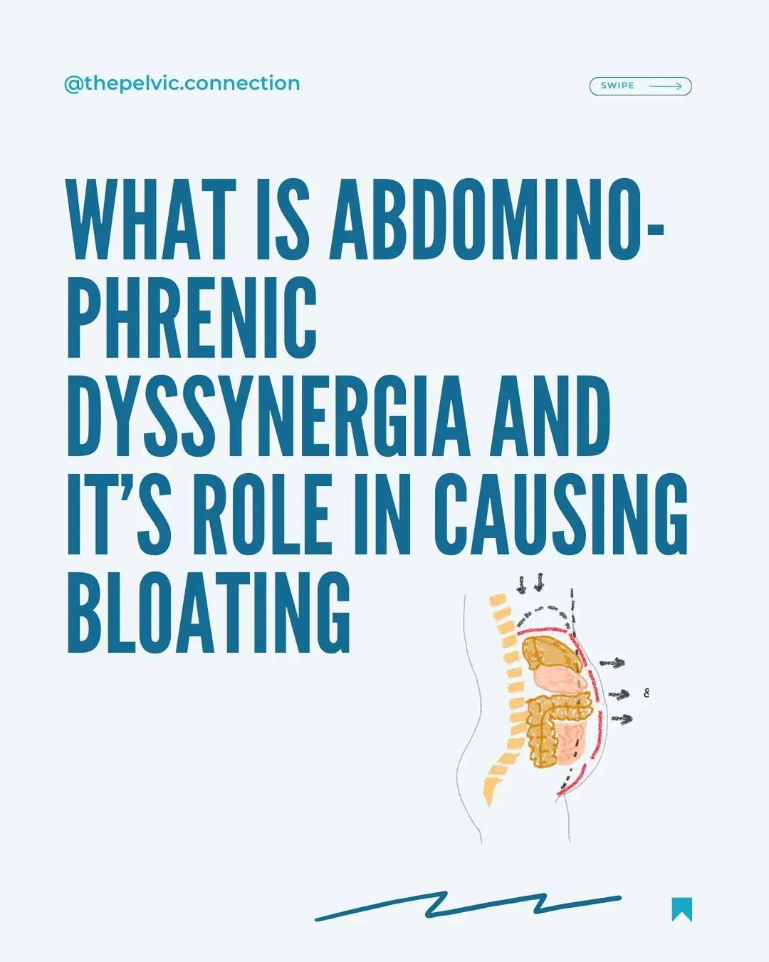 Let’s talk about APD